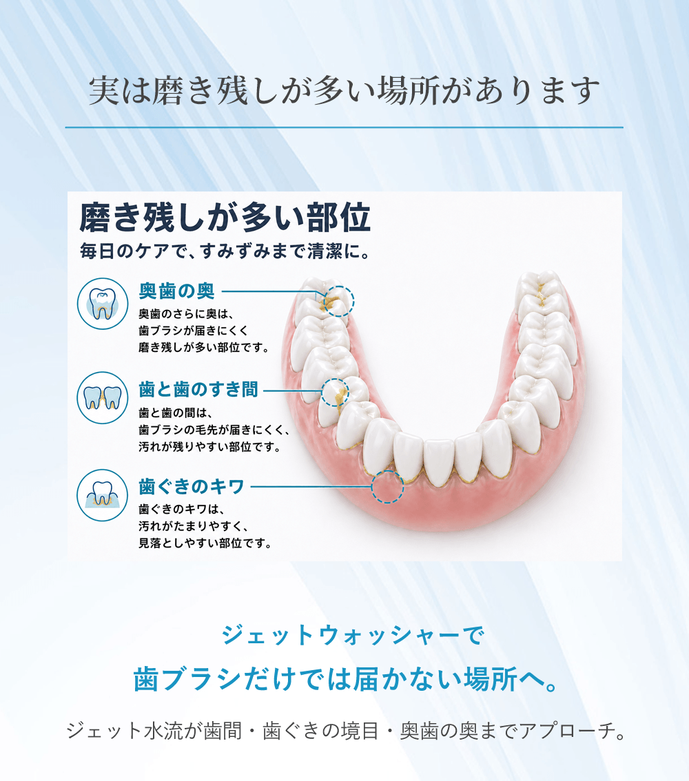 実は磨き残しが多い場所があります ジェットウォッシャーで歯ブラシだけでは届かない場所へ