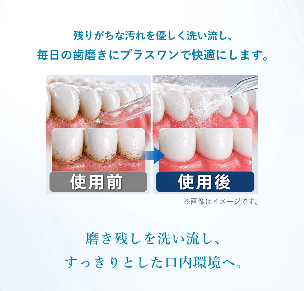 残りがちな汚れを優しく洗い流し、毎日の歯磨きにプラスワンで快適にします。磨き残しを洗い流し、すっきりとした口内環境へ。